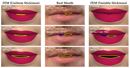 detecting lip contours